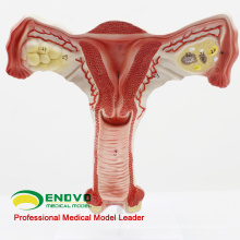 SELL 12443 Model Uterus Show Female Genital Structures Uterine Anatomy Model